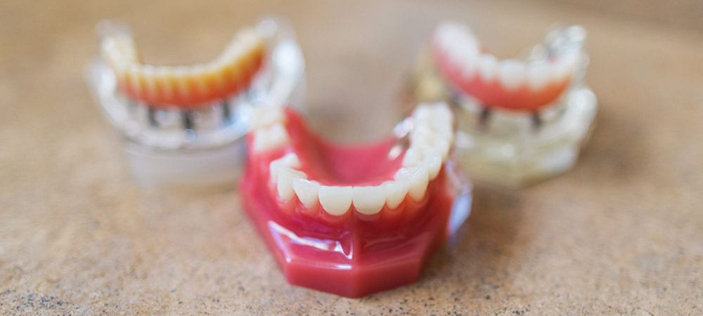 Three 3D teeth models
